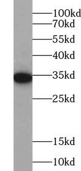 PIK3IP1 Rabbit Polyclonal Antibody