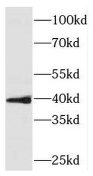PINX1 Rabbit Polyclonal Antibody