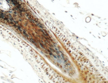 PINX1 Rabbit Polyclonal Antibody