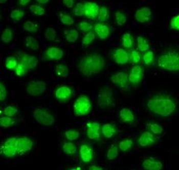 PIP4K2A Rabbit Polyclonal Antibody