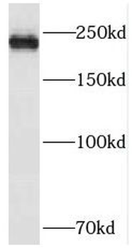 PIKFYVE Rabbit Polyclonal Antibody