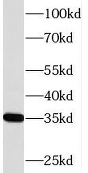 PIR Rabbit Polyclonal Antibody
