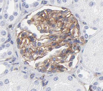 PISD Rabbit Polyclonal Antibody