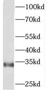 PITPNA Rabbit Polyclonal Antibody