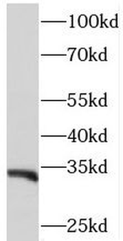PITPNB Rabbit Polyclonal Antibody