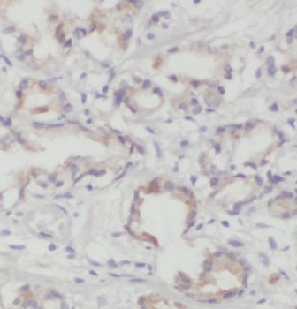 PITPNB Rabbit Polyclonal Antibody