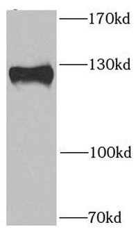 PITRM1 Antibody