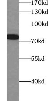 PRKCB Rabbit Polyclonal Antibody