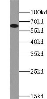 PRKCI Rabbit Polyclonal Antibody