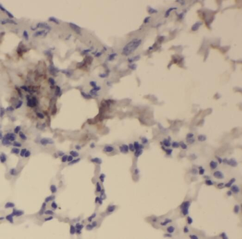 PKLR Rabbit Polyclonal Antibody