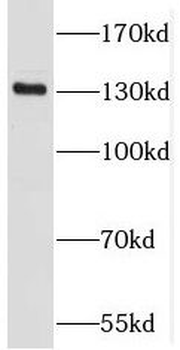 PKN2 Rabbit Polyclonal Antibody