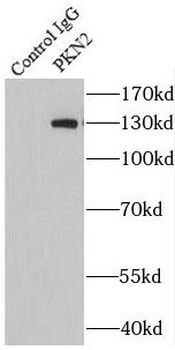 PKN2 Rabbit Polyclonal Antibody