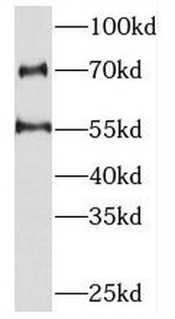 PKNOX2 Antibody