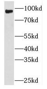 PLA2G4D Rabbit Polyclonal Antibody