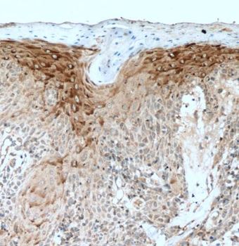PLA2G4D Rabbit Polyclonal Antibody