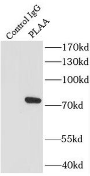 PLAA Rabbit Polyclonal Antibody