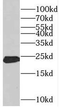 CSH1 Rabbit Polyclonal Antibody