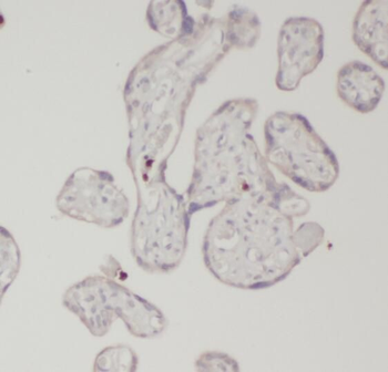 CSH1 Rabbit Polyclonal Antibody