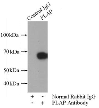 ALPP Rabbit Polyclonal Antibody