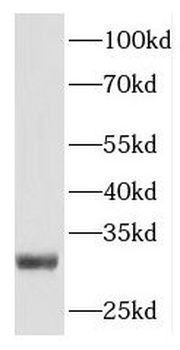 PLEKHF1 Rabbit Polyclonal Antibody