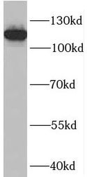PLEKHG5 Rabbit Polyclonal Antibody