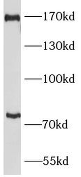 PLXNB2 Rabbit Polyclonal Antibody