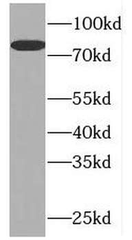 PLK2 Rabbit Polyclonal Antibody