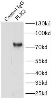 PLK2 Rabbit Polyclonal Antibody