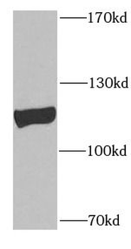 PLK4 Rabbit Polyclonal Antibody