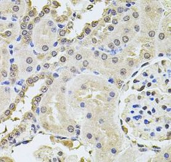 PLK4 Rabbit Polyclonal Antibody