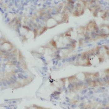 PLS1 Rabbit Polyclonal Antibody