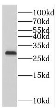PMM1 Rabbit Polyclonal Antibody