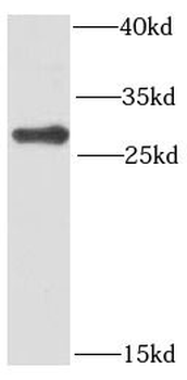 PMM2 Rabbit Polyclonal Antibody