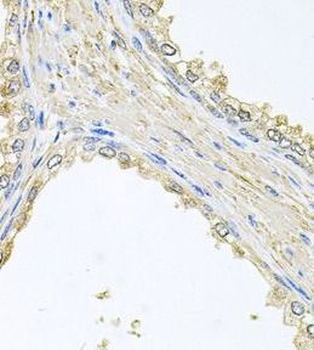 PMM2 Rabbit Polyclonal Antibody
