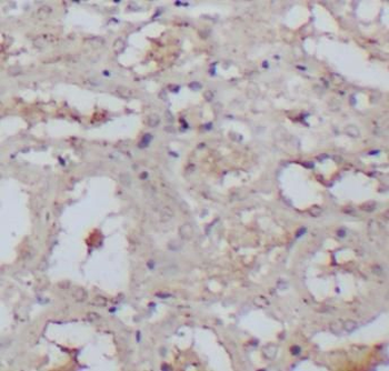PMS2 Rabbit Polyclonal Antibody