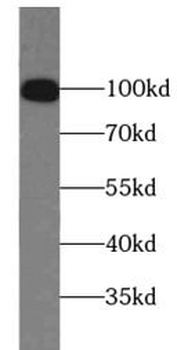 PMS2 Mouse Monoclonal Antibody