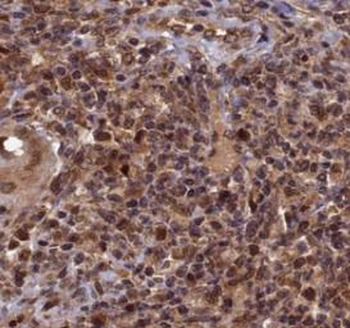 PMS2 Mouse Monoclonal Antibody