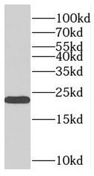 PMVK Rabbit Polyclonal Antibody