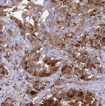 PNKD Rabbit Polyclonal Antibody