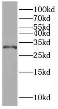 PNMT Rabbit Polyclonal Antibody