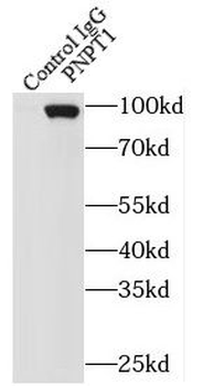 PNPT1 Rabbit Polyclonal Antibody