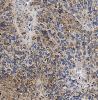 PNPT1 Rabbit Polyclonal Antibody