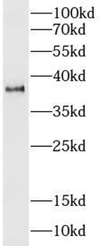 PDPN Rabbit Polyclonal Antibody