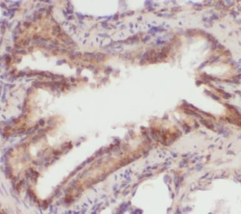 PDPN Rabbit Polyclonal Antibody