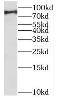 POGK Rabbit Polyclonal Antibody