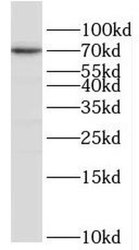POLA2 Rabbit Polyclonal Antibody
