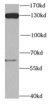POLD1 Rabbit Polyclonal Antibody