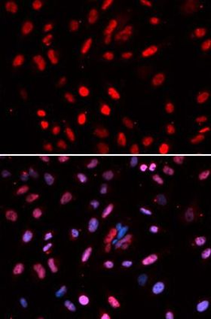 POLD1 Rabbit Polyclonal Antibody