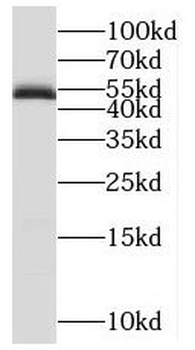 POLD2 Rabbit Polyclonal Antibody
