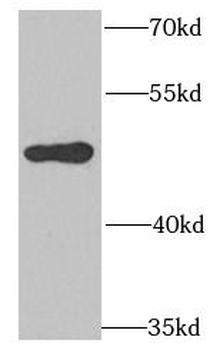 POLD3 Rabbit Polyclonal Antibody